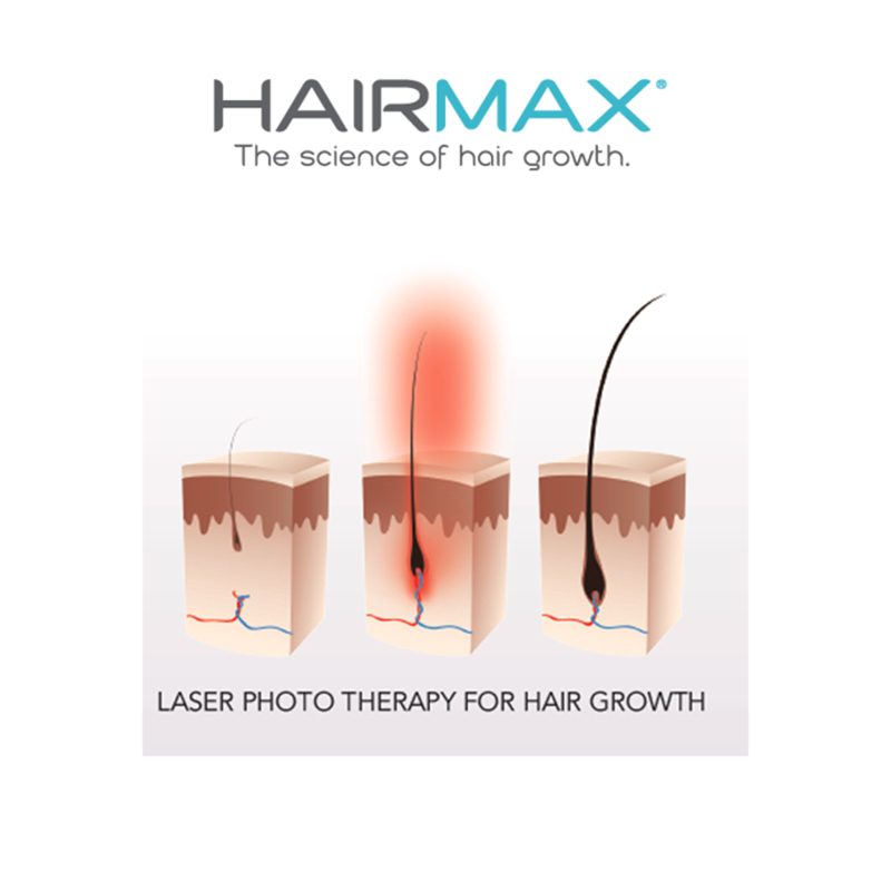 HairMax®頭皮活化健康套裝 (Laserband 82+毛囊激活素)